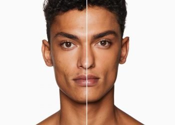 cach het vet tham do mun cho nam gioi