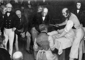 Robert Liston