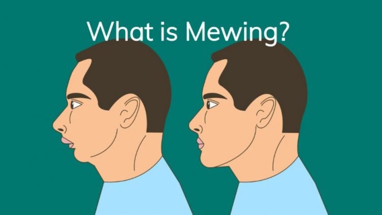 mewing là gì
