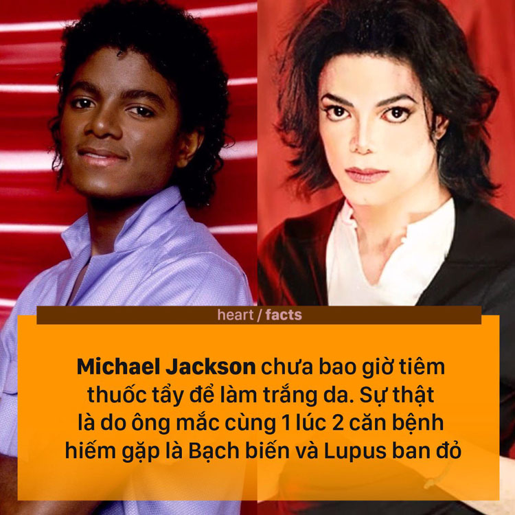 Michael Jackson thay đổi màu da