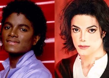 sự thật về màu da của Michael Jackson