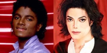 sự thật về màu da của Michael Jackson